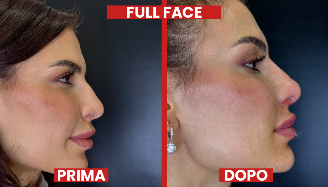 Prima-dopo-FULLFACE2