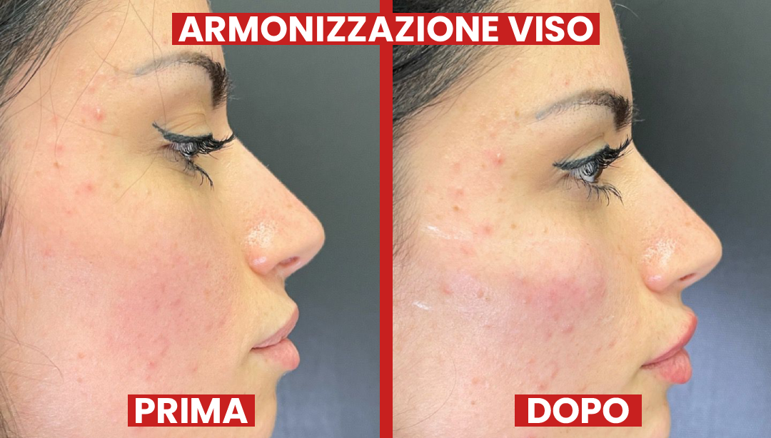 Prima-dopo-armonizzazione-laclinic2