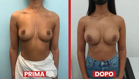 Prima-dopo1-2.webp