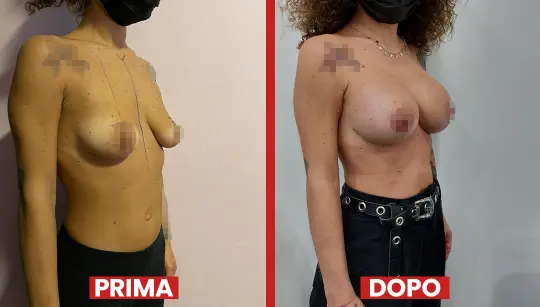 Prima-dopo11-2.webp