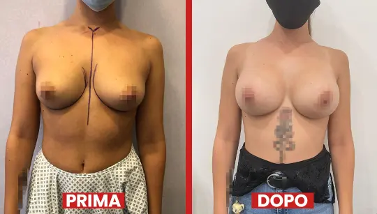 Prima-dopo4-2.webp