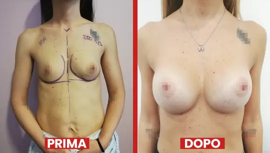 Prima-dopo5-2.webp