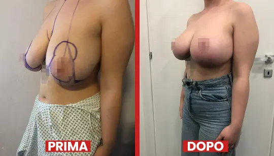 Prima-dopo7-2.webp